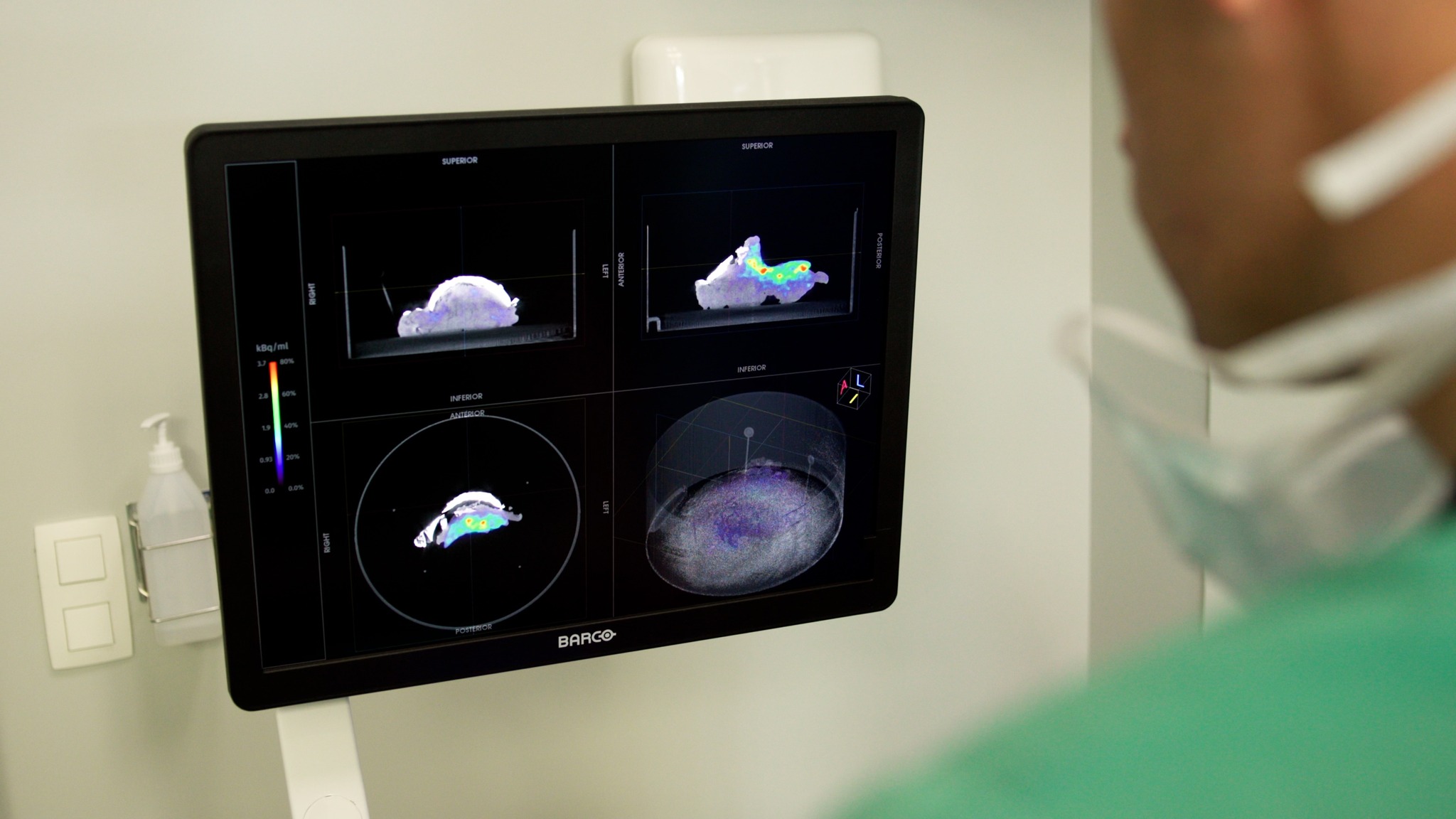 🧠 Medische primeur in Aalst: AZORG brengt kankerchirurgie naar een nieuw niveau